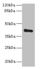 ZDHHC4 Antibody - Western blot All lanes: ZDHHC4 antibody at 1.5µg/ml + Mouse liver tissue Secondary Goat polyclonal to rabbit IgG at 1/10000 dilution Predicted band size: 40 kDa Observed band size: 40 kDa