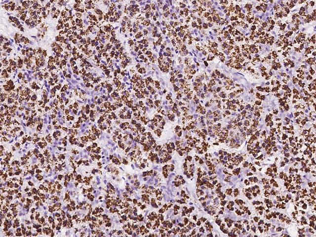 ZDHHC4 Antibody - Immunochemical staining of human ZDHHC4 in human pancreas with rabbit polyclonal antibody at 1:100 dilution, formalin-fixed paraffin embedded sections.