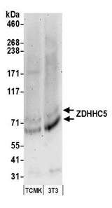 ZDHHC5 Antibody - Detection of mouse ZDHHC5 by western blot. Samples: Whole cell lysate (50 µg) from TCMK-1 and NIH 3T3 cells prepared using NETN lysis buffer. Antibodies: Affinity purified rabbit anti-ZDHHC5 antibody used for WB at 0.1 µg/ml. Detection: Chemiluminescence with an exposure time of 3 minutes.
