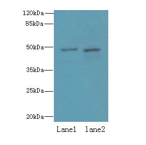 ZDHHC6 Antibody - Western blot. All lanes: ZDHHC6 antibody at 0.2 ug/ml. Lane 1: NIH/3T3 whole cell lysate. Lane 2: K562 whole cell lysate. Secondary Goat polyclonal to Rabbit IgG at 1:10000 dilution. Predicted band size: 48 kDa. Observed band size: 48 kDa.