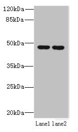 ZDHHC6 Antibody - Western blot All lanes: ZDHHC6 antibody at 0.2µg/ml Lane 1: NIH/3T3 whole cell lysate Lane 2: K562 whole cell lysate Secondary Goat polyclonal to rabbit IgG at 1/10000 dilution Predicted band size: 48 kDa Observed band size: 48 kDa