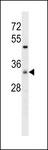ZDHHC7 Antibody - ZDHC7 Antibody western blot of HeLa cell line lysates (35 ug/lane). The ZDHC7 antibody detected the ZDHC7 protein (arrow).