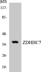 ZDHHC7 Antibody - Western blot analysis of the lysates from HUVECcells using ZDHHC7 antibody.