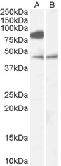 ZDHHC8 Antibody - Antibody (0.1 ug/ml) staining of Human Brain (Frontal Cortex) lysate (35 ug protein in RIPA buffer) with (B) and without (A) blocking with the immunizing peptide. Primary incubation was 1 hour. Detected by chemiluminescence.