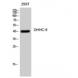 ZDHHC9 Antibody - Western blot of DHHC-9 antibody