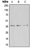 ZDHHC9 Antibody - Western blot analysis of ZDHHC9 expression in HeLa (A); mouse kidney (B); rat brain (C) whole cell lysates.