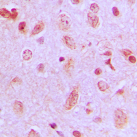ZDHHC9 Antibody - Immunohistochemical analysis of ZDHHC9 staining in human brain formalin fixed paraffin embedded tissue section. The section was pre-treated using heat mediated antigen retrieval with sodium citrate buffer (pH 6.0). The section was then incubated with the antibody at room temperature and detected using an HRP conjugated compact polymer system. DAB was used as the chromogen. The section was then counterstained with hematoxylin and mounted with DPX.
