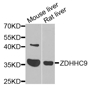 ZDHHC9 Antibody - Western blot analysis of extracts of various cells.