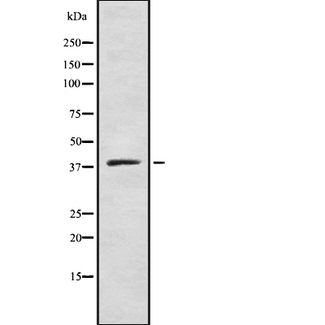 ZDHHC9 Antibody - Western blot analysis of DHHC-9 using COLO205 whole cells lysates