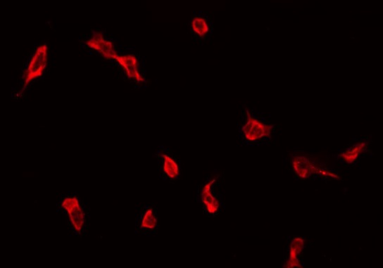 ZDHHC9 Antibody - Staining COLO205 cells by IF/ICC. The samples were fixed with PFA and permeabilized in 0.1% Triton X-100, then blocked in 10% serum for 45 min at 25°C. The primary antibody was diluted at 1:200 and incubated with the sample for 1 hour at 37°C. An Alexa Fluor 594 conjugated goat anti-rabbit IgG (H+L) Ab, diluted at 1/600, was used as the secondary antibody.