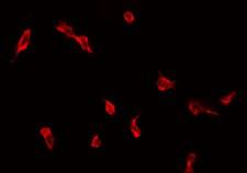 ZDHHC9 Antibody - Staining COLO205 cells by IF/ICC. The samples were fixed with PFA and permeabilized in 0.1% Triton X-100, then blocked in 10% serum for 45 min at 25°C. The primary antibody was diluted at 1:200 and incubated with the sample for 1 hour at 37°C. An Alexa Fluor 594 conjugated goat anti-rabbit IgG (H+L) Ab, diluted at 1/600, was used as the secondary antibody.