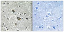 ZDHHC9 Antibody - Peptide - + Immunohistochemistry analysis of paraffin-embedded human brain tissue using ZDHHC9 antibody.