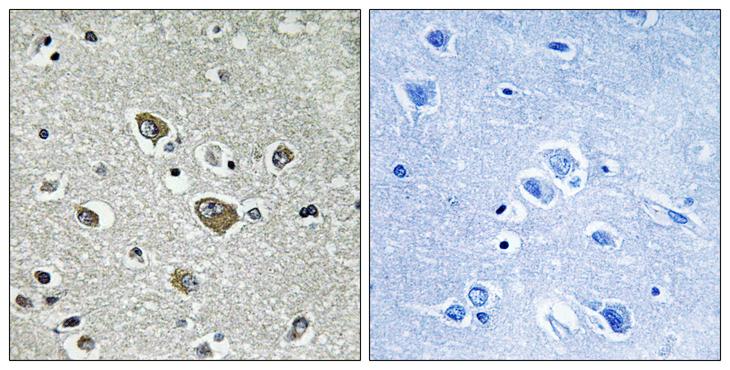 ZDHHC9 Antibody - Peptide - + Immunohistochemistry analysis of paraffin-embedded human brain tissue using ZDHHC9 antibody.