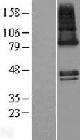 ZDHHC9 Protein - Western validation with an anti-DDK antibody * L: Control HEK293 lysate R: Over-expression lysate