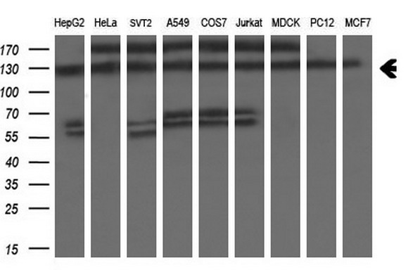 ZEB1 / AREB6 Antibody - Western blot of extracts (35ug) from 9 different cell lines by using anti-ZEB1 monoclonal antibody at 1:200 dilution. (HepG2: human; HeLa: human; SVT2: mouse; A549: human; COS7: monkey; Jurkat: human; MDCK: canine; PC12: rat; MCF7: human).