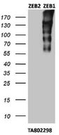 ZEB1 / AREB6 Antibody - Cross-reactivity test with ZEB2: HEK293T cells were transfected with plasmids overexpressing either ZEB2 (left) or ZEB1 (right) and immunoblotted with anti-ZEB1.