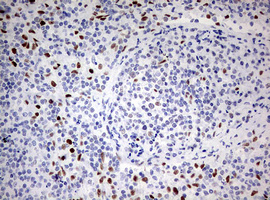 ZEB1 / AREB6 Antibody - IHC of paraffin-embedded Human lymph node tissue using anti-ZEB1 mouse monoclonal antibody. (Heat-induced epitope retrieval by 10mM citric buffer, pH6.0, 120°C for 3min).
