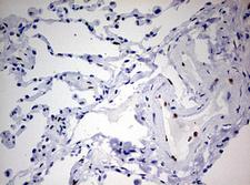 ZEB1 / AREB6 Antibody - IHC of paraffin-embedded Human lung tissue using anti-ZEB1 mouse monoclonal antibody. (Heat-induced epitope retrieval by 10mM citric buffer, pH6.0, 120°C for 3min).