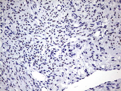 ZEB1 / AREB6 Antibody - IHC of paraffin-embedded Human endometrium tissue using anti-ZEB1 mouse monoclonal antibody. (Heat-induced epitope retrieval by 1 mM EDTA in 10mM Tris, pH8.5, 120°C for 3min).