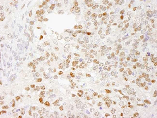 ZEB1 / AREB6 Antibody - Detection of Mouse ZEB1 by Immunohistochemistry. Sample: FFPE section of mouse teratoma. Antibody: Affinity purified rabbit anti-ZEB1 used at a dilution of 1:250.