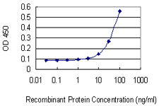 ZEB1 / AREB6 Antibody - Detection limit for recombinant GST tagged ZEB1 is 3 ng/ml as a capture antibody.