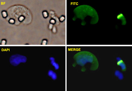 ZEB1 / AREB6 Antibody - U-2 OS cells were stained with ZEB1-FITC labeled monoclonal antibody (Green). The cell nucleus were counterstained with DAPI (Blue).