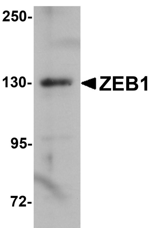 ZEB1 / AREB6 Antibody - Western blot analysis of ZEB1 in HeLa cell lysate with ZEB1 antibody at 1ug/ml.