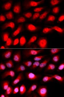 ZEB1 / AREB6 Antibody - Immunofluorescence analysis of U20S cell using ZEB1 antibody. Blue: DAPI for nuclear staining.