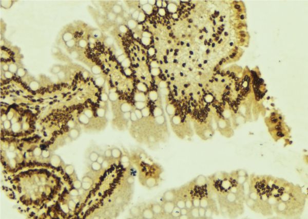 ZEB1 / AREB6 Antibody - 1:100 staining mouse colon tissue by IHC-P. The sample was formaldehyde fixed and a heat mediated antigen retrieval step in citrate buffer was performed. The sample was then blocked and incubated with the antibody for 1.5 hours at 22°C. An HRP conjugated goat anti-rabbit antibody was used as the secondary.