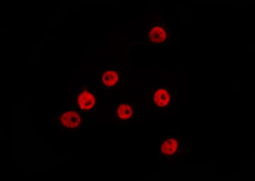 ZEB1 / AREB6 Antibody - Staining HeLa cells by IF/ICC. The samples were fixed with PFA and permeabilized in 0.1% Triton X-100, then blocked in 10% serum for 45 min at 25°C. The primary antibody was diluted at 1:200 and incubated with the sample for 1 hour at 37°C. An Alexa Fluor 594 conjugated goat anti-rabbit IgG (H+L) Ab, diluted at 1/600, was used as the secondary antibody.
