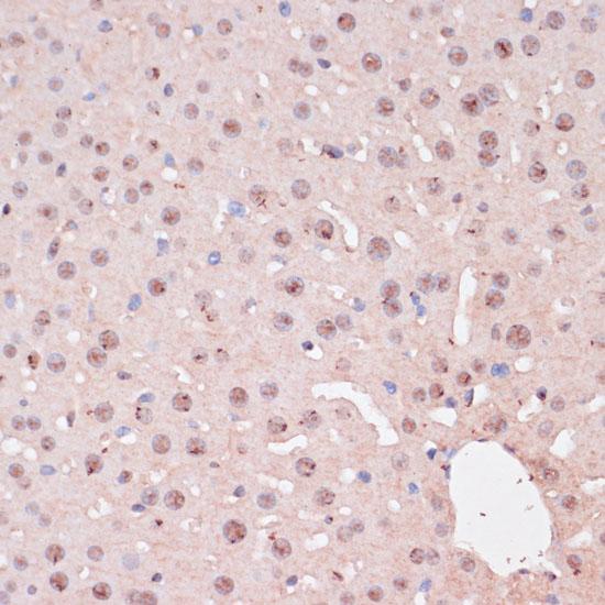 ZEB1 / AREB6 Antibody - Immunohistochemistry of paraffin-embedded Mouse liver using ZEB1 Polyclonal Antibody at dilution of 1:100 (40x lens).