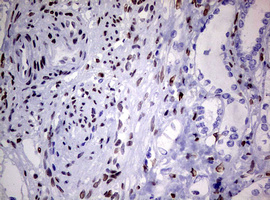 ZEB2 / SIP-1 Antibody - IHC of paraffin-embedded Human Kidney tissue using anti-ZEB2 mouse monoclonal antibody. (Heat-induced epitope retrieval by 10mM citric buffer, pH6.0, 120°C for 3min).