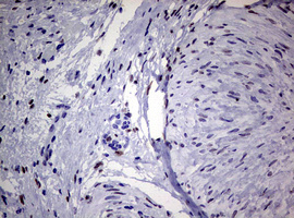 ZEB2 / SIP-1 Antibody - IHC of paraffin-embedded Human Ovary tissue using anti-ZEB2 mouse monoclonal antibody. (Heat-induced epitope retrieval by 10mM citric buffer, pH6.0, 120°C for 3min).