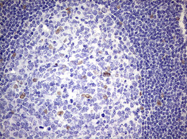 ZEB2 / SIP-1 Antibody - IHC of paraffin-embedded Human tonsil using anti-ZEB2 mouse monoclonal antibody. (Heat-induced epitope retrieval by 10mM citric buffer, pH6.0, 120°C for 3min).