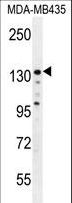 ZEB2 / SIP-1 Antibody - ZEB2 Antibody western blot of MDA-MB435 cell line lysates (35 ug/lane). The ZEB2 antibody detected the ZEB2 protein (arrow).