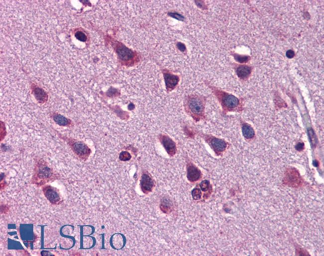 ZEB2 / SIP-1 Antibody - Anti-ZEB2 antibody IHC of human brain, cortex. Immunohistochemistry of formalin-fixed, paraffin-embedded tissue after heat-induced antigen retrieval. Antibody concentration 5 ug/ml.  This image was taken for the unconjugated form of this product. Other forms have not been tested.