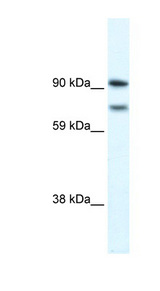 ZEB2 / SIP-1 Antibody - ZEB2 antibody Western blot of Fetal brain lysate. This image was taken for the unconjugated form of this product. Other forms have not been tested.