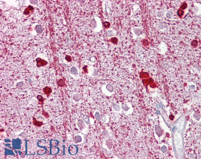 ZEB2 / SIP-1 Antibody - Anti-ZEB2 antibody IHC of human brain, cortex. Immunohistochemistry of formalin-fixed, paraffin-embedded tissue after heat-induced antigen retrieval. Antibody concentration 5 ug/ml.  This image was taken for the unconjugated form of this product. Other forms have not been tested.