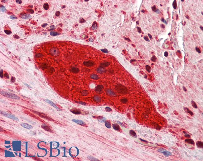ZEB2 / SIP-1 Antibody - Anti-ZEB2 antibody IHC of human small intestine, myenteric plexus. Immunohistochemistry of formalin-fixed, paraffin-embedded tissue after heat-induced antigen retrieval. Antibody concentration 2.5 ug/ml.  This image was taken for the unconjugated form of this product. Other forms have not been tested.