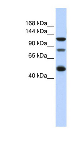 ZEB2 / SIP-1 Antibody - ZEB2 antibody Western blot of HeLa lysate. This image was taken for the unconjugated form of this product. Other forms have not been tested.