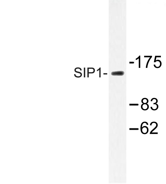 ZEB2 / SIP-1 Antibody - Western blot of SIP1 (E101) pAb in extracts from HepG2 cells.
