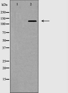 ZEB2 / SIP-1 Antibody - Western blot analysis of ZEB2 expression in HepG2 cells lysate. The lane on the left is treated with the antigen-specific peptide.