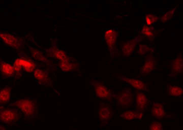 ZEB2 / SIP-1 Antibody - Staining HepG2 cells by IF/ICC. The samples were fixed with PFA and permeabilized in 0.1% Triton X-100, then blocked in 10% serum for 45 min at 25°C. The primary antibody was diluted at 1:200 and incubated with the sample for 1 hour at 37°C. An Alexa Fluor 594 conjugated goat anti-rabbit IgG (H+L) Ab, diluted at 1/600, was used as the secondary antibody.
