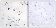 ZEB2 / SIP-1 Antibody - Peptide - + Immunohistochemistry analysis of paraffin-embedded human brain tissue using ZEB2 antibody.