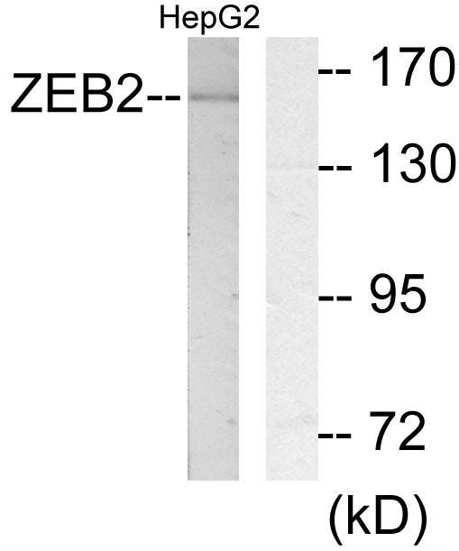 ZEB2 / SIP-1 Antibody - Western blot analysis of extracts from HepG2 cells, using ZEB2 antibody.