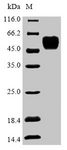 COPS2 / TRIP15 / ALIEN Protein - (Tris-Glycine gel) Discontinuous SDS-PAGE (reduced) with 5% enrichment gel and 15% separation gel.