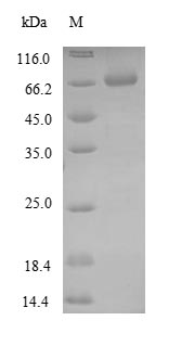 GFAP Protein - (Tris-Glycine gel) Discontinuous SDS-PAGE (reduced) with 5% enrichment gel and 15% separation gel.