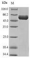 HYKK / AGPHD1 Protein - (Tris-Glycine gel) Discontinuous SDS-PAGE (reduced) with 5% enrichment gel and 15% separation gel.