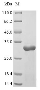 IL-1B / IL-1 Beta Protein - (Tris-Glycine gel) Discontinuous SDS-PAGE (reduced) with 5% enrichment gel and 15% separation gel.