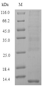 MT-2 Protein - (Tris-Glycine gel) Discontinuous SDS-PAGE (reduced) with 5% enrichment gel and 15% separation gel.